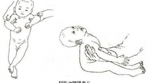 新生儿体检时间及项目介绍