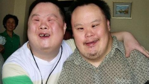唐氏综合症 长得好不好出门靠一张脸(唐氏儿会腿长吗)