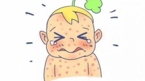 【幼儿急疹】--宝宝发烧先别急，看看这个~~