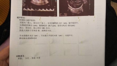 巨大儿与胎儿体重估计