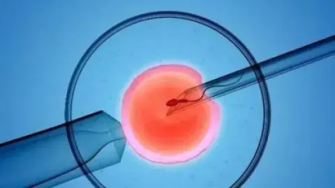广州做试管婴儿有年龄限制吗？