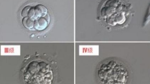 三代试管婴儿的优势，成功率取决于什么？
